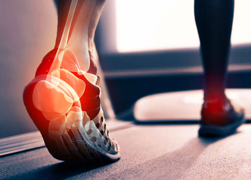 láb- és ízületi fájdalom járás közben
